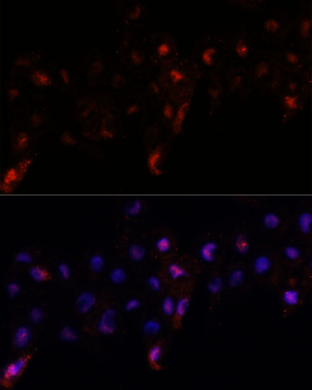 Anti-USP18 Antibody (CAB16739)