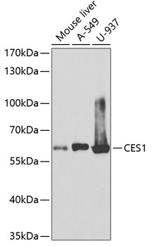 Anti-CES1 Antibody (CAB1853)