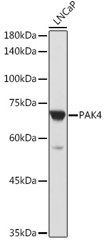 Anti-PAK4 Antibody (CAB11646)