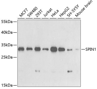 Anti-SPIN1 Antibody (CAB5853)