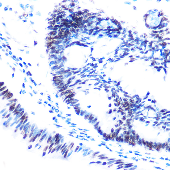 Anti-Phospho-SMC1A-S957 Antibody (CABP0090)