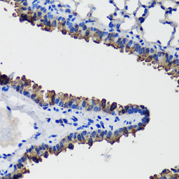 Anti-SCGB1A1 Antibody (CAB16997)