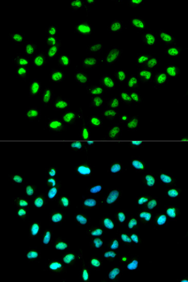 Anti-HNRNPK Antibody (CAB1701)