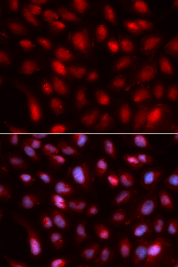 Anti-SUMO2 Antibody (CAB2571)