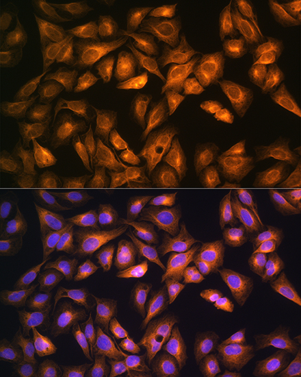 Anti-SOAT1 Antibody (CAB6311)