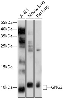 Anti-GNG2 Antibody (CAB10309)