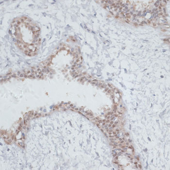 Anti-NOL3 Antibody (CAB6319)