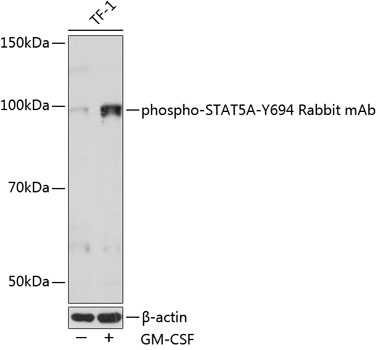 Anti-Phospho-STAT5A-Y694 Antibody (CABP0758)