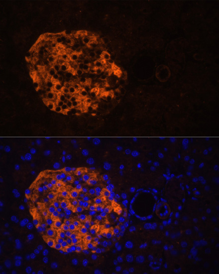 Anti-PNLIPRP2 Antibody (CAB12895)