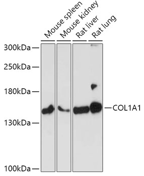 Anti-COL1A1 Antibody (CAB1352)