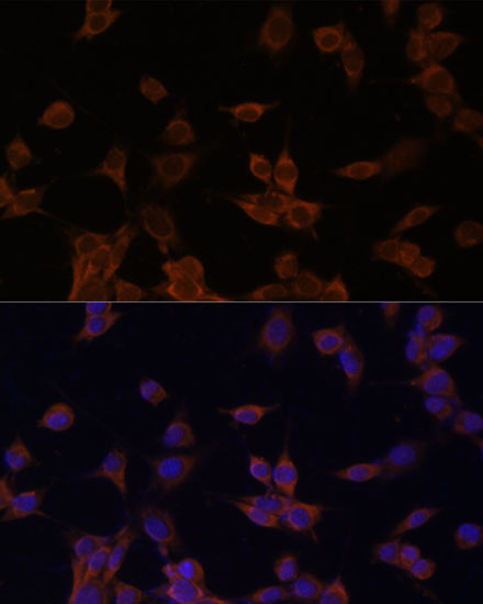 Anti-HMGCR Antibody [KO Validated] (CAB16876)