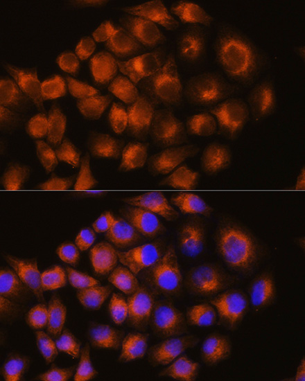 Anti-ADORA2A Antibody (CAB1587)