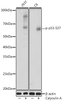 Anti-Phospho-p53-S37 Antibody (CABP1110)