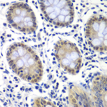 Anti-GTF2F2 Antibody (CAB13497)