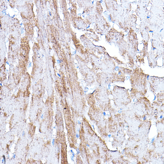 Anti-PDK4 Antibody (CAB3069)