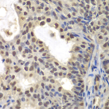 Anti-CENPC Antibody (CAB6557)