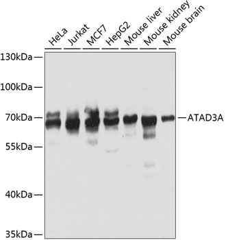 Anti-ATAD3A Polyclonal Antibody (CAB8230)