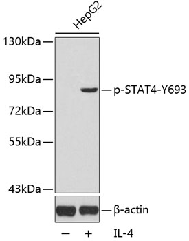 Anti-Phospho-STAT4-Y693 Antibody (CABP0137)