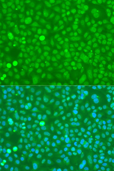 Anti-UBC Antibody (CAB3207)