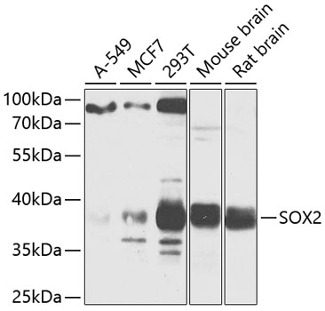 Anti-SOX2 Antibody (CAB11501)