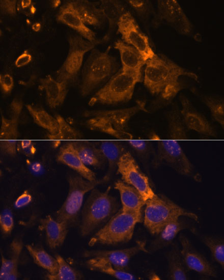 Anti-TIMP2 Antibody (CAB1558)