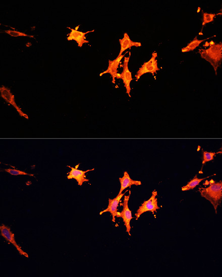 Anti-MST1 Antibody (CAB12963)