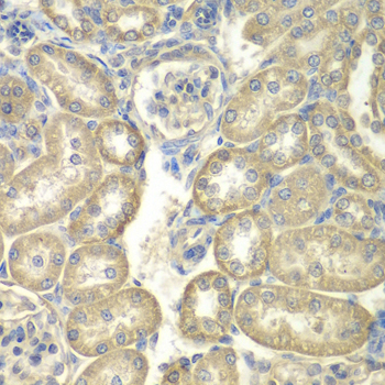 Anti-ACSL5 Antibody (CAB1270)