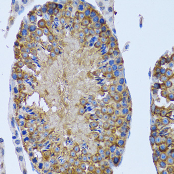 Anti-EIF2AK4 Antibody (CAB12618)