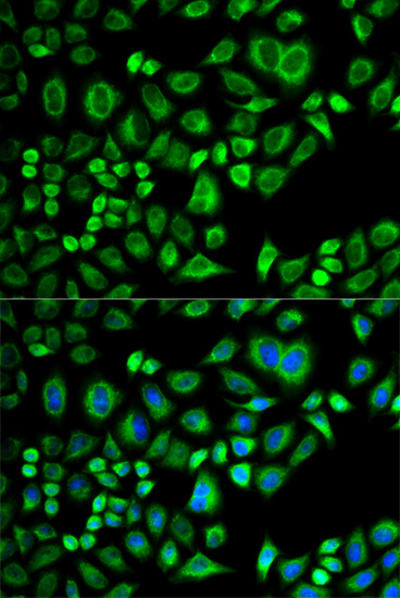 Anti-APOD Antibody (CAB5297)