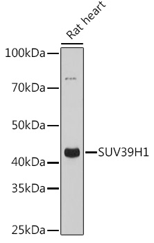 Anti-SUV39H1 Antibody (CAB3277)