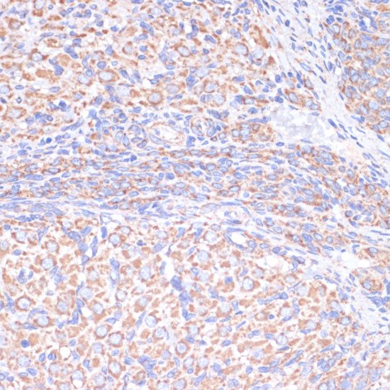 Anti-COX5A Antibody (CAB6437)