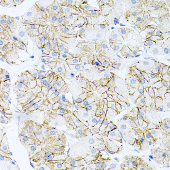 Anti-IL-17A Antibody (CAB12454)