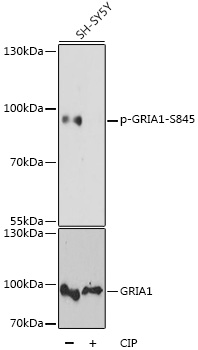 Anti-Phospho-GRIA1-S845 pAb (CABP0825)