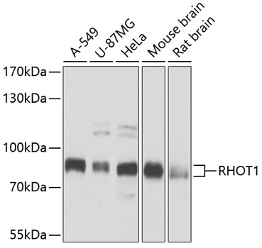 Anti-RHOT1 Antibody (CAB5838)