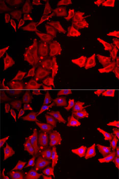 Anti-THRSP Antibody (CAB7232)