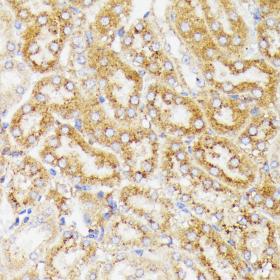 Anti-GALC Antibody (CAB3873)