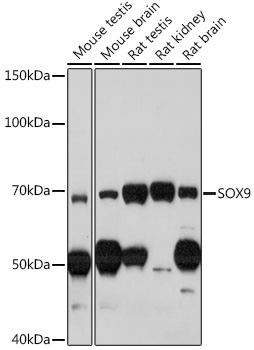 Anti-SOX9 Antibody (CAB2479)