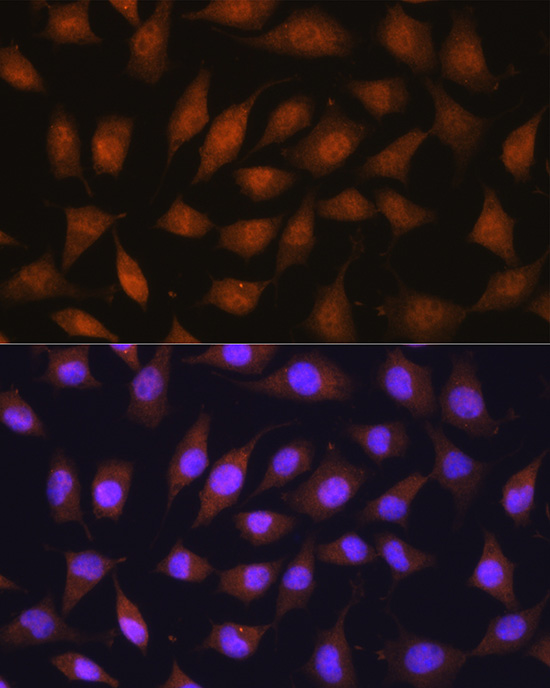 Anti-RPSA Polyclonal Antibody (CAB9008)