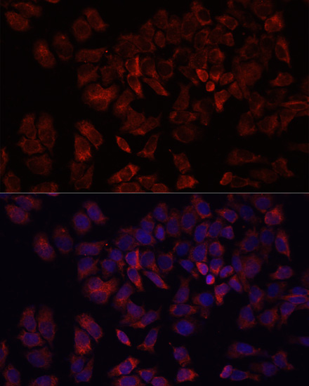 Anti-ARF5 Antibody (CAB3737)