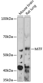 Anti-MiTF Antibody