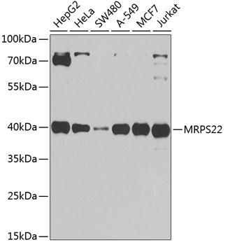 Anti-MRPS22 Polyclonal Antibody (CAB8319)