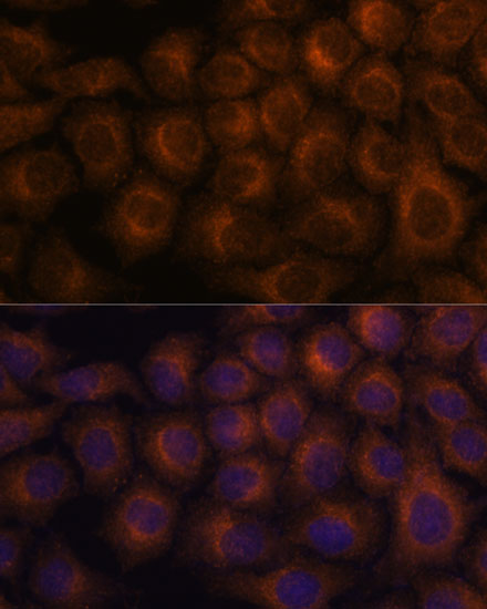 Anti-VAV3 Antibody (CAB15385)