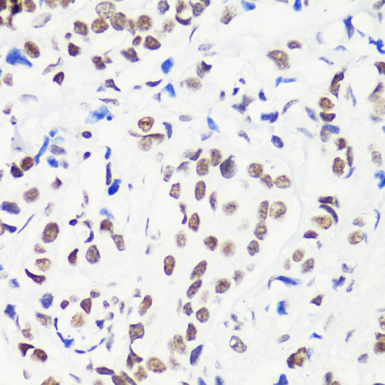 Anti-MonoMethyl-Histone H3-R8 Antibody (CAB3156)