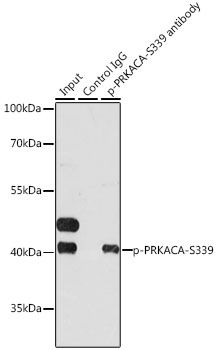 Anti-Phospho-PRKACA-S339 Antibody (CABP0558)