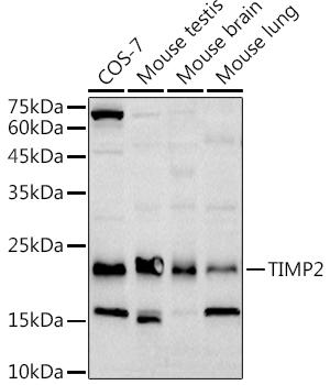 Western blot analysis of extracts of various cell lines, using TIMP2 antibody at 1:1000 dilution. Secondary antibody: HRP Goat Anti-Rabbit IgG (H+L) at 1:10000 dilution. Lysates/proteins: 25ug per lane. Blocking buffer: 3% nonfat dry milk in TBST. Detection: ECL Basic Kit. Exposure time: 60s.