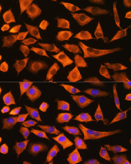 Anti-EEF1A1 Antibody (CAB0974)