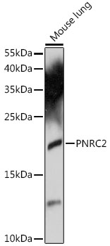 Anti-PNRC2 Antibody (CAB16549)