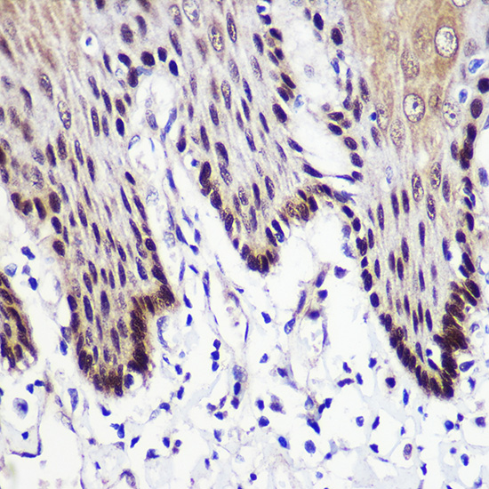 Anti-TKT Antibody (CAB6314)