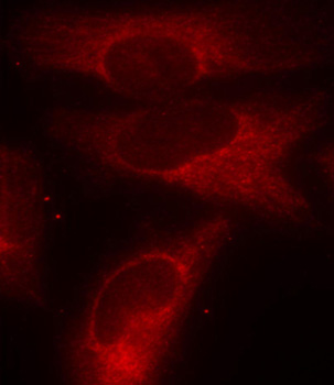 Anti-Phospho-YWHAZ-S58 Antibody (CABP0195)