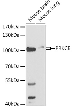 Anti-PRKCE Antibody (CAB2110)